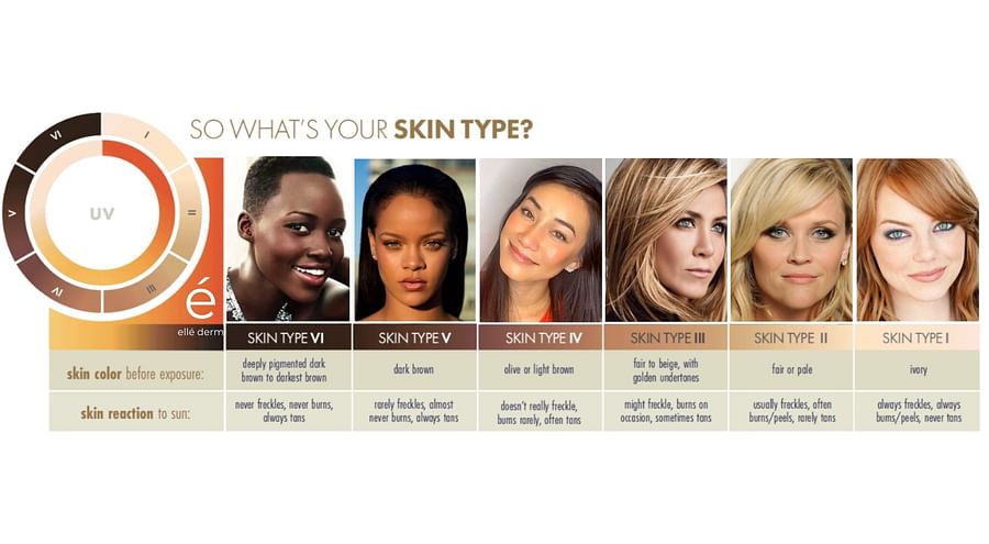Chart of skin types